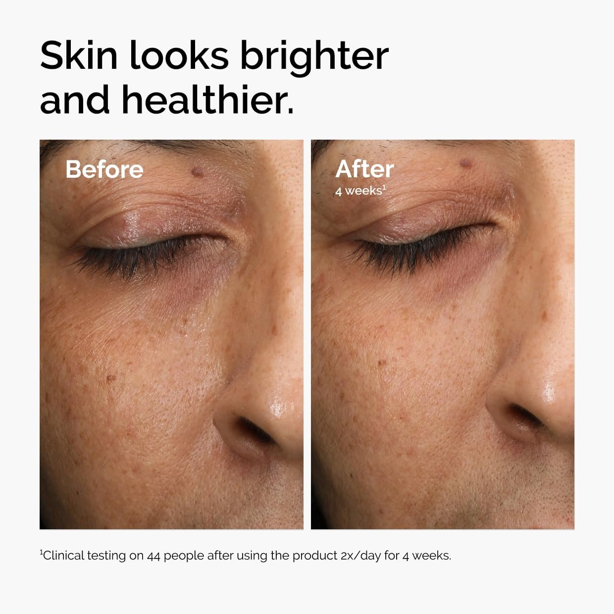 The Ordinary Multi-Antioxidant Radiance Serum, Vitamin C Serum For Face, Brighten & Protect Skin – Boosts Glow & Shields Against Environmental Stressors, 1 Fl Oz - Image 4